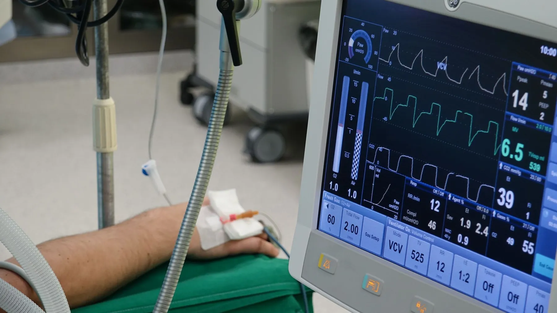 A monitor in an operating room, illustrating how safety is judged.