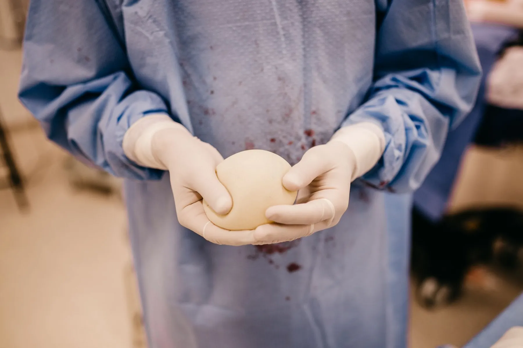 A medical implant on a sterile tray, illustrating the device details worth asking about.