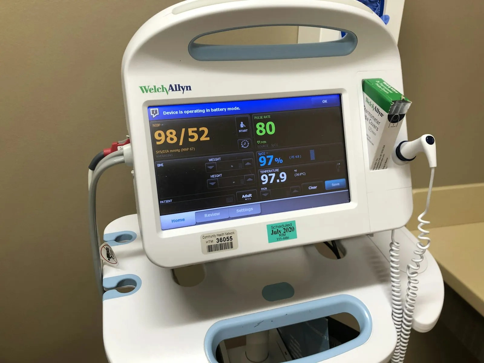 A monitor displaying vital signs, illustrating anaesthetic monitoring during surgery.