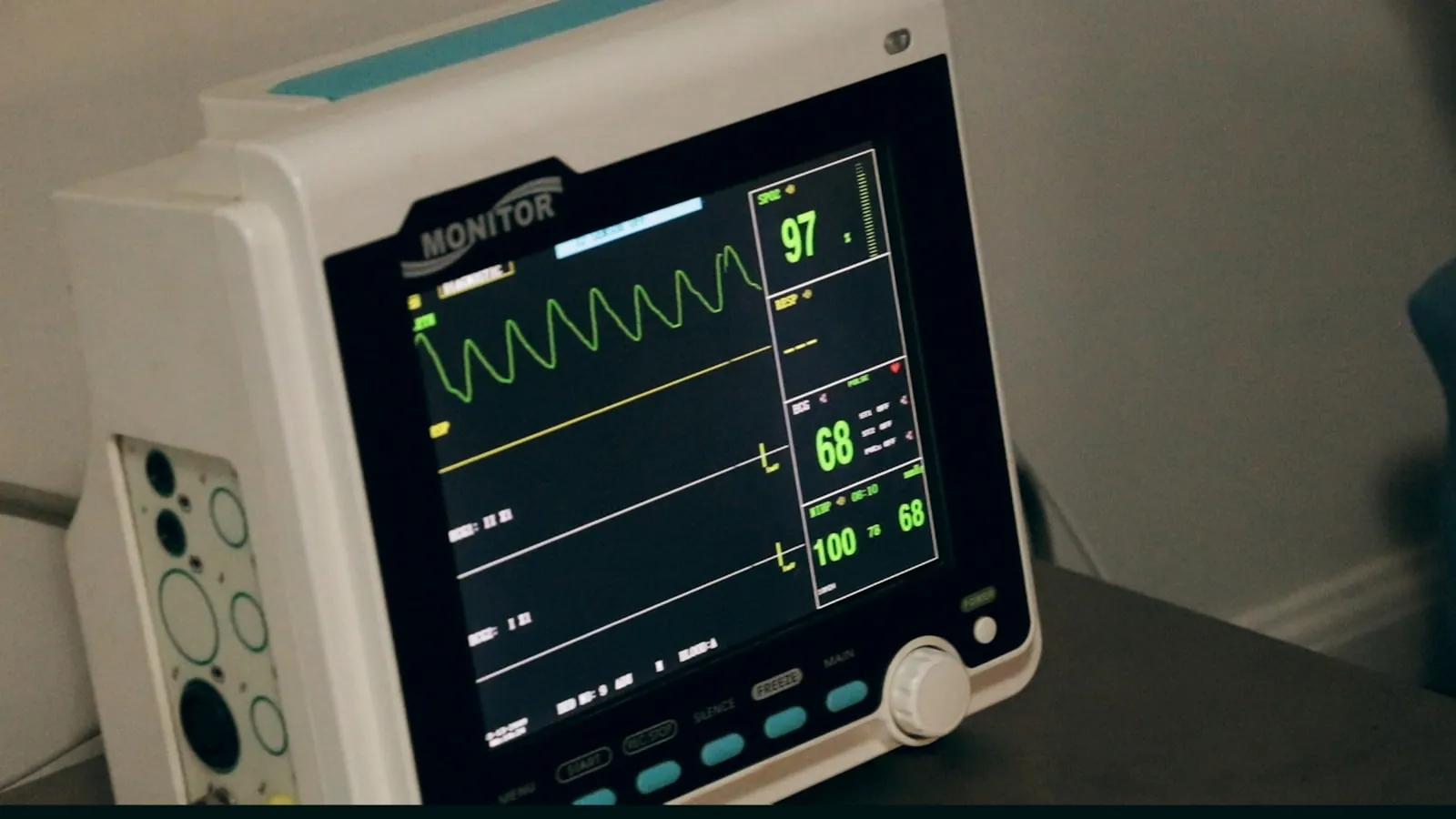 An anaesthetic machine in a hospital, illustrating the anaesthetic a facelift requires.