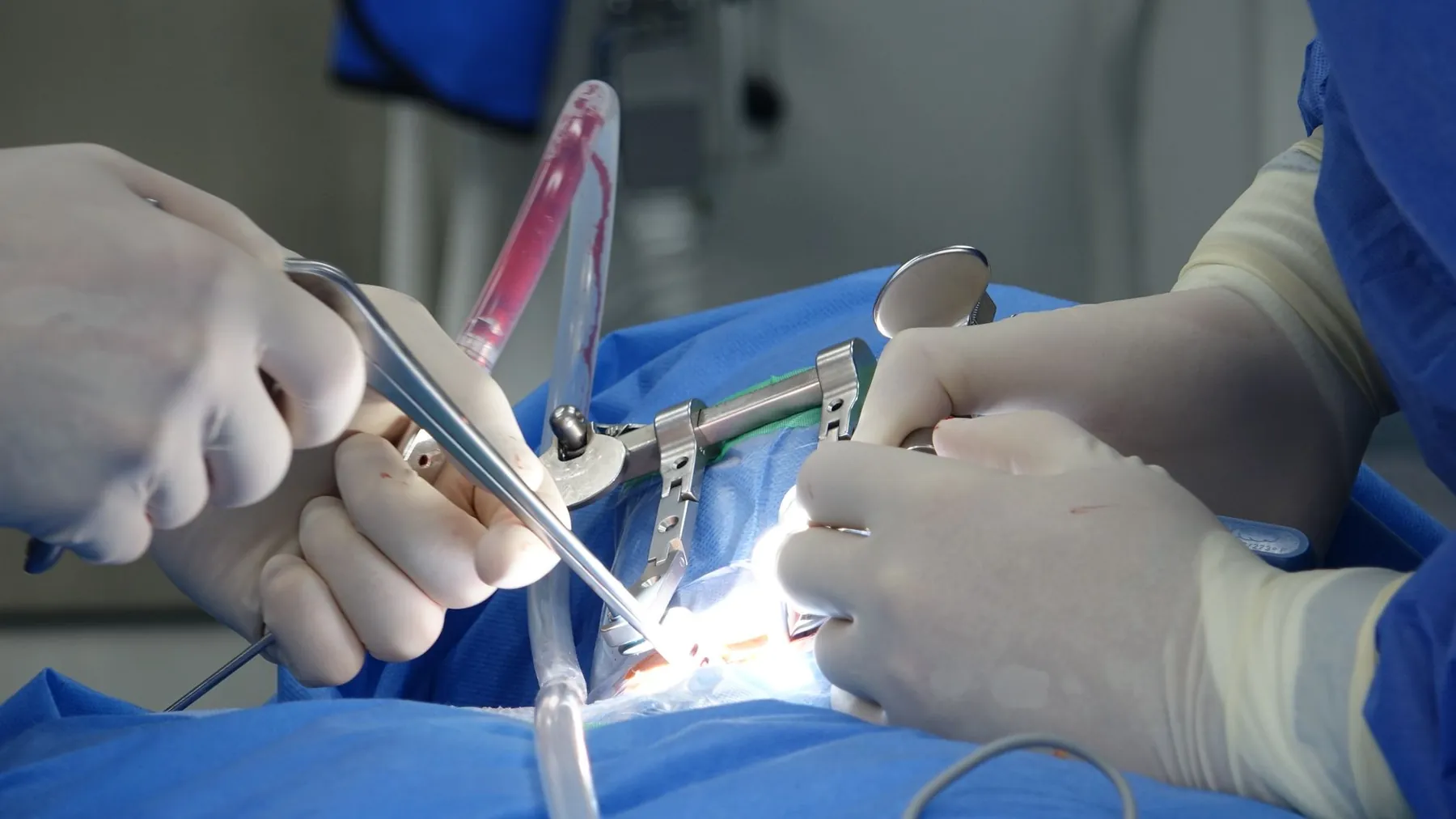 Gloved hands during an operation, illustrating the work done beneath the skin.