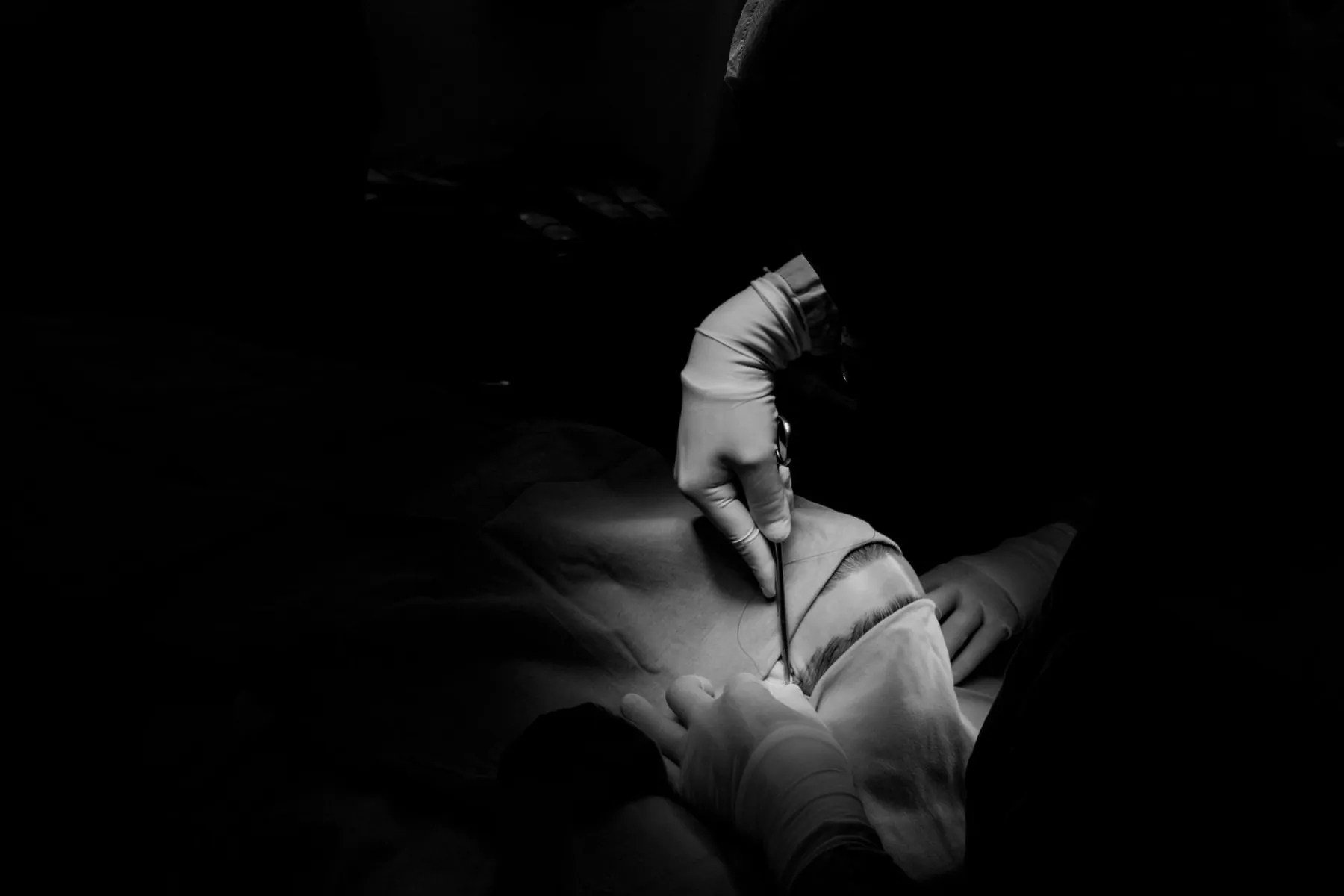 Fine suture thread, illustrating whether an approach leaves stitches.