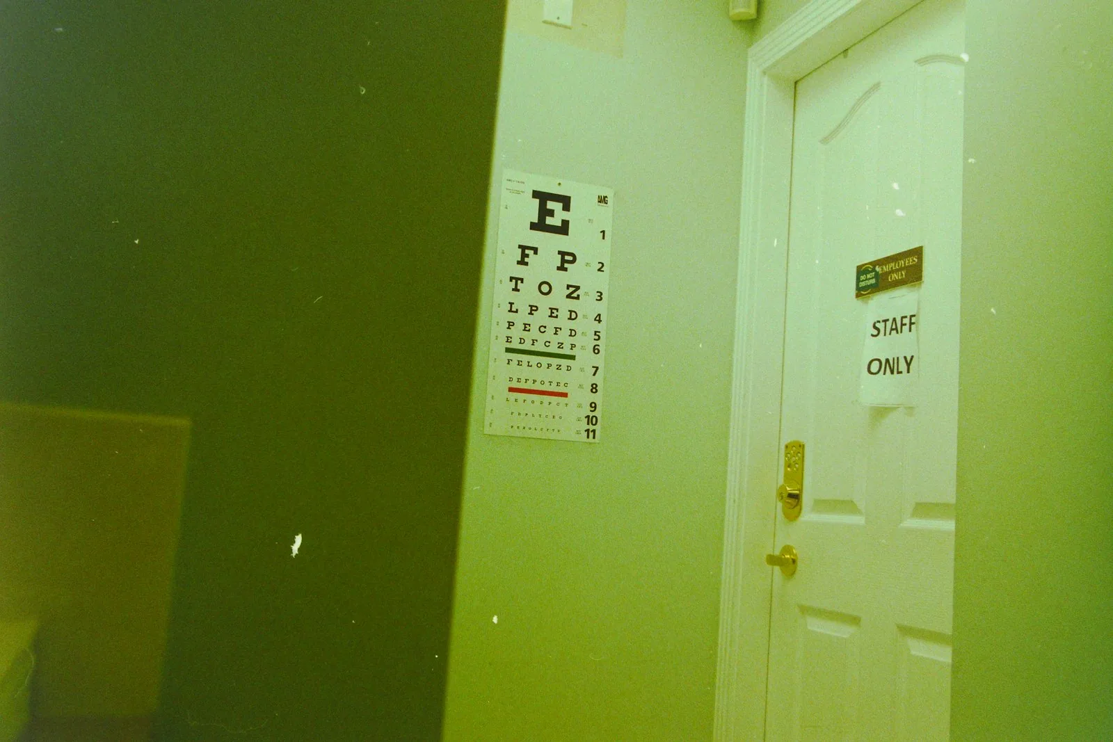 Illustrative photograph of a professional clinical setting accompanying information about Lower Eyelid Surgery