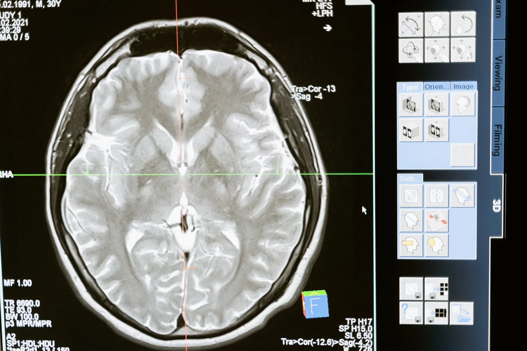 A medical imaging screen, illustrating asking whether breast imaging is advised beforehand.